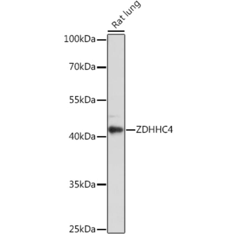 Western Blot - Anti-ZDHHC4/DC1 Antibody (A93357) - Antibodies.com