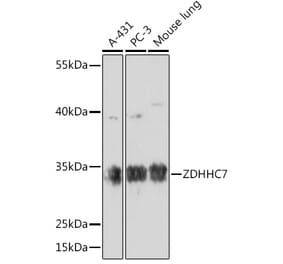 Western Blot - Anti-ZDHHC7 Antibody (A93358) - Antibodies.com