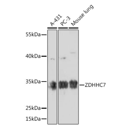 Western Blot - Anti-ZDHHC7 Antibody (A93358) - Antibodies.com