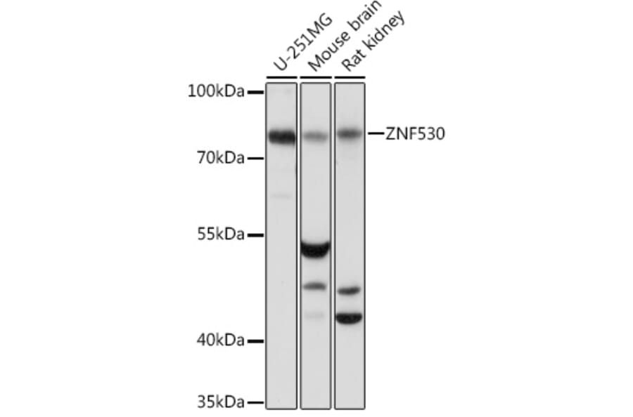 Western Blot - Anti-ZNF530 Antibody (A93360) - Antibodies.com