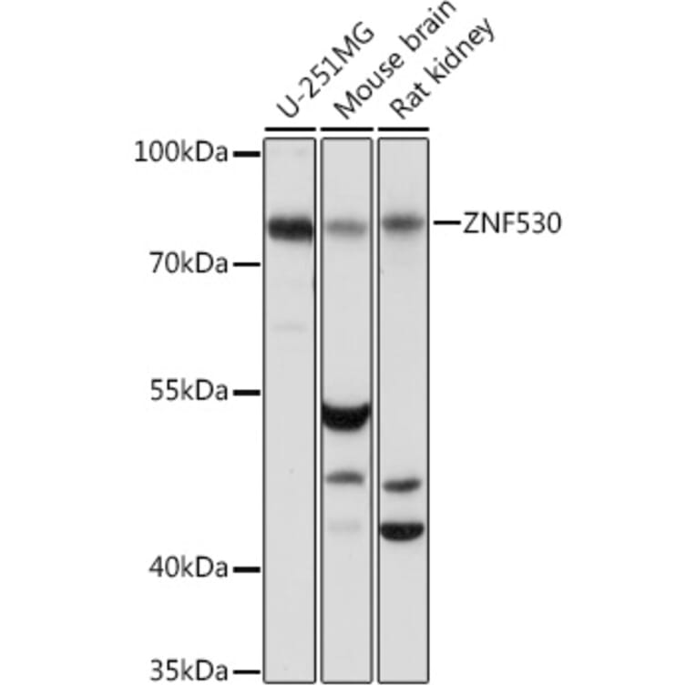 Western Blot - Anti-ZNF530 Antibody (A93360) - Antibodies.com