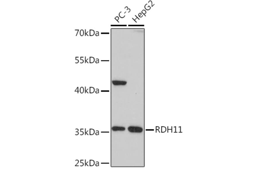 Western Blot - Anti-T7 Tag Antibody [AMC0508] (A93364) - Antibodies.com