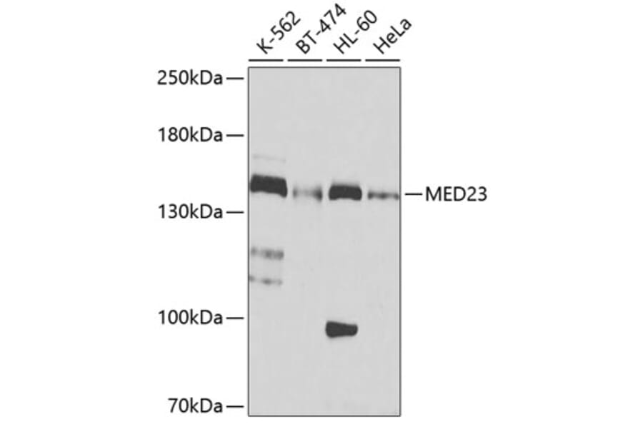 Western Blot - Anti-HA Tag Antibody [AMC0517] (Affinity Gel) (A93367) - Antibodies.com