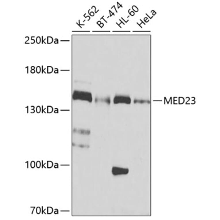 Western Blot - Anti-HA Tag Antibody [AMC0517] (Affinity Gel) (A93367) - Antibodies.com