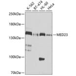 Western Blot - Anti-HA Tag Antibody [AMC0517] (Affinity Gel) (A93367) - Antibodies.com