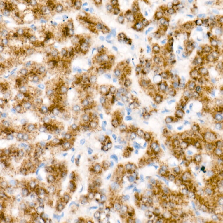 Immunohistochemistry - Goat Anti-Mouse IgG1 Antibody (HRP) (A93381) - Antibodies.com