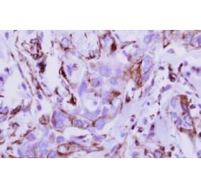 Immunohistochemical analysis - breast cancer - Antibodies.com