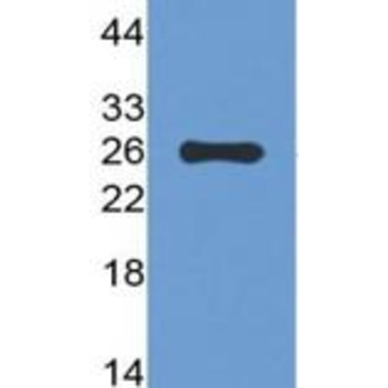 Western Blot - Anti-TIGIT (13E7) - Antibodies.com