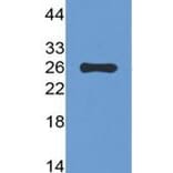 Western Blot - Anti-TIGIT (13E7) - Antibodies.com