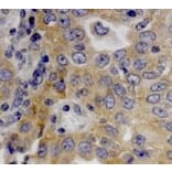 Immunohistochemical analysis - Anti-Dicer Antibody (4A6) - Antibodies.com
