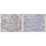 Immunohistochemical analysis - Anti-Dicer Antibody (13D6R) - Antibodies.com