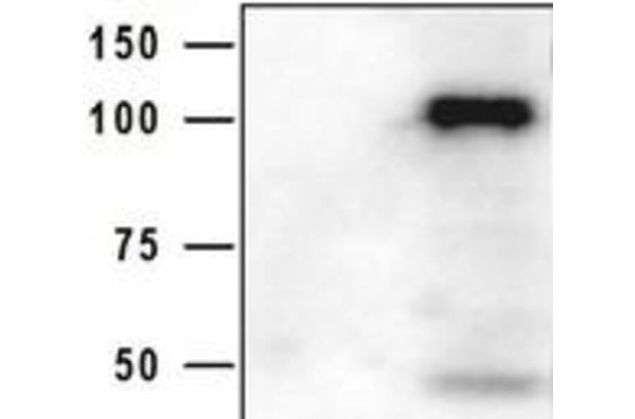 Western Blot - Anti-HIV GP120 Antibody (5B12) - Antibodies.com