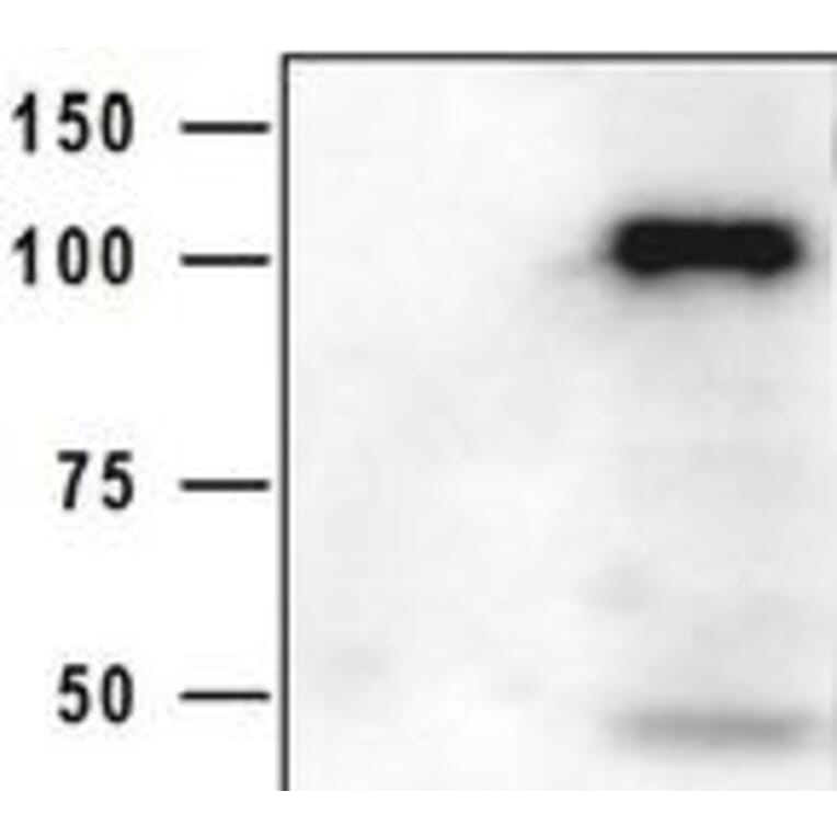 Western Blot - Anti-HIV GP120 Antibody (5B12) - Antibodies.com