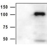 Western Blot - Anti-HIV GP120 Antibody (5B12) - Antibodies.com