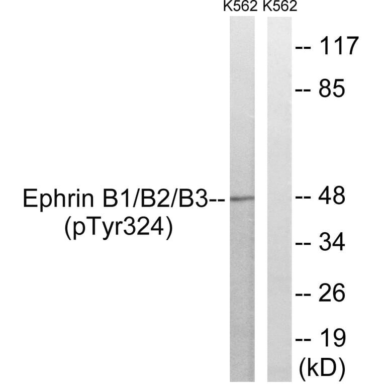 Western Blot - Anti-Ephrin B1 + B2 + B3 (phospho Tyr324) Antibody (A8281) - Antibodies.com