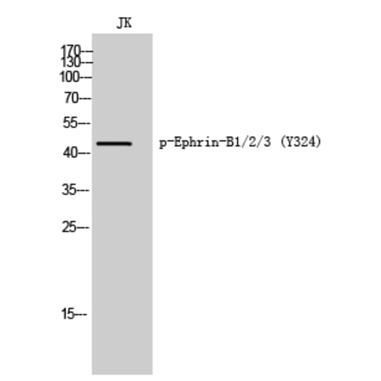 Western Blot - Anti-Ephrin B1 + B2 + B3 (phospho Tyr324) Antibody (A8281) - Antibodies.com