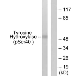 Western Blot - Anti-Tyrosine Hydroxylase (phospho Ser40) Antibody (A0039) - Antibodies.com
