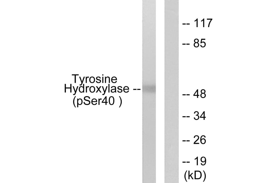 Western Blot - Anti-Tyrosine Hydroxylase (phospho Ser40) Antibody (A0039) - Antibodies.com