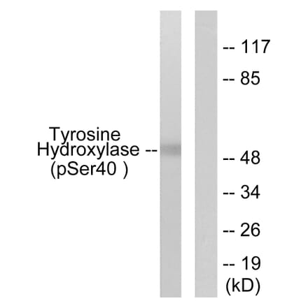 Western Blot - Anti-Tyrosine Hydroxylase (phospho Ser40) Antibody (A0039) - Antibodies.com