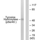 Western Blot - Anti-Tyrosine Hydroxylase (phospho Ser40) Antibody (A0039) - Antibodies.com