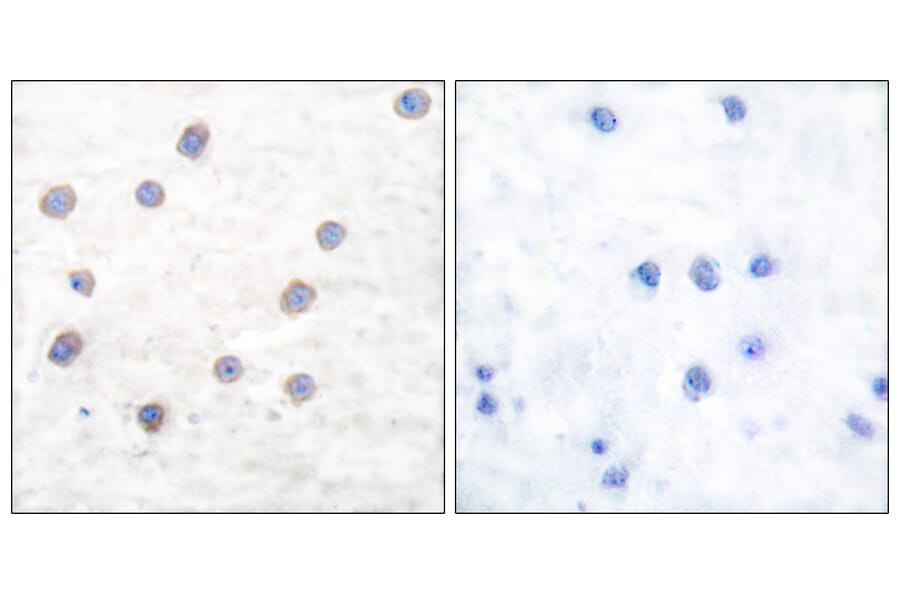 Immunohistochemistry - Anti-Tyrosine Hydroxylase (phospho Ser40) Antibody (A0039) - Antibodies.com