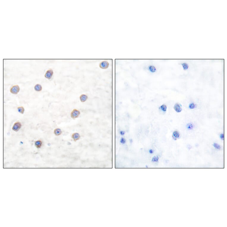 Immunohistochemistry - Anti-Tyrosine Hydroxylase (phospho Ser40) Antibody (A0039) - Antibodies.com