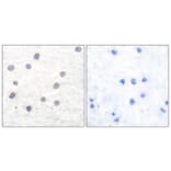 Immunohistochemistry - Anti-Tyrosine Hydroxylase (phospho Ser40) Antibody (A0039) - Antibodies.com