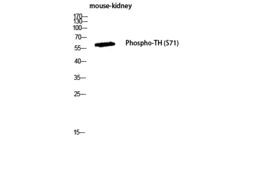 Western Blot - Anti-Tyrosine Hydroxylase (phospho Ser40) Antibody (A0039) - Antibodies.com