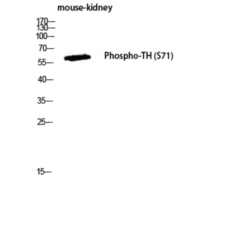 Western Blot - Anti-Tyrosine Hydroxylase (phospho Ser40) Antibody (A0039) - Antibodies.com