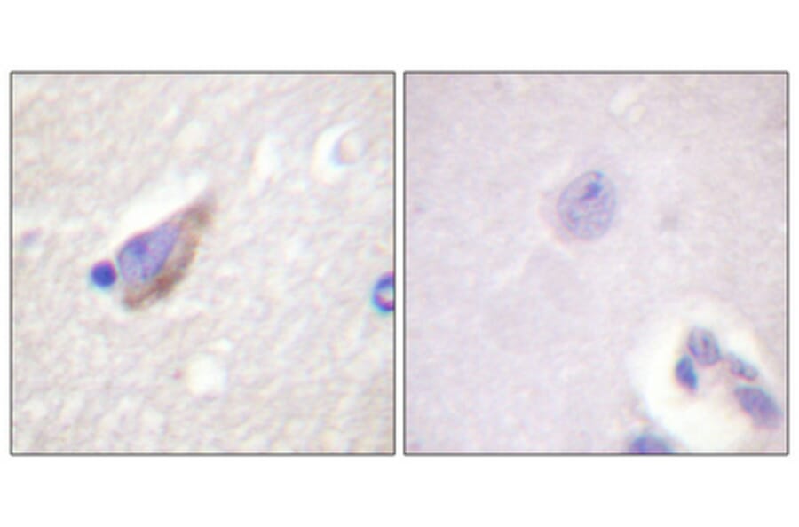 Immunohistochemistry - Anti-Tyrosine Hydroxylase (phospho Ser40) Antibody (A0039) - Antibodies.com