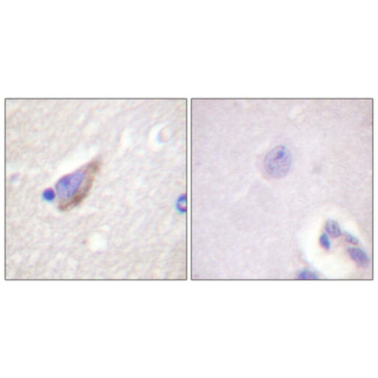 Immunohistochemistry - Anti-Tyrosine Hydroxylase (phospho Ser40) Antibody (A0039) - Antibodies.com