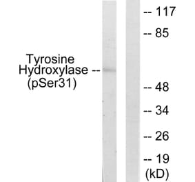 Western Blot - Anti-Tyrosine Hydroxylase (phospho Ser31) Antibody (A0038) - Antibodies.com