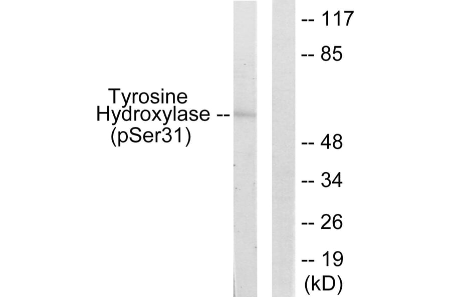 Western Blot - Anti-Tyrosine Hydroxylase (phospho Ser31) Antibody (A0038) - Antibodies.com