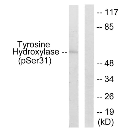 Western Blot - Anti-Tyrosine Hydroxylase (phospho Ser31) Antibody (A0038) - Antibodies.com