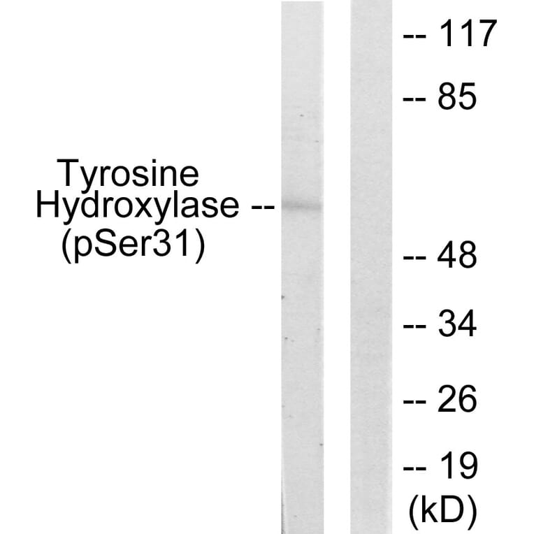 Western Blot - Anti-Tyrosine Hydroxylase (phospho Ser31) Antibody (A0038) - Antibodies.com