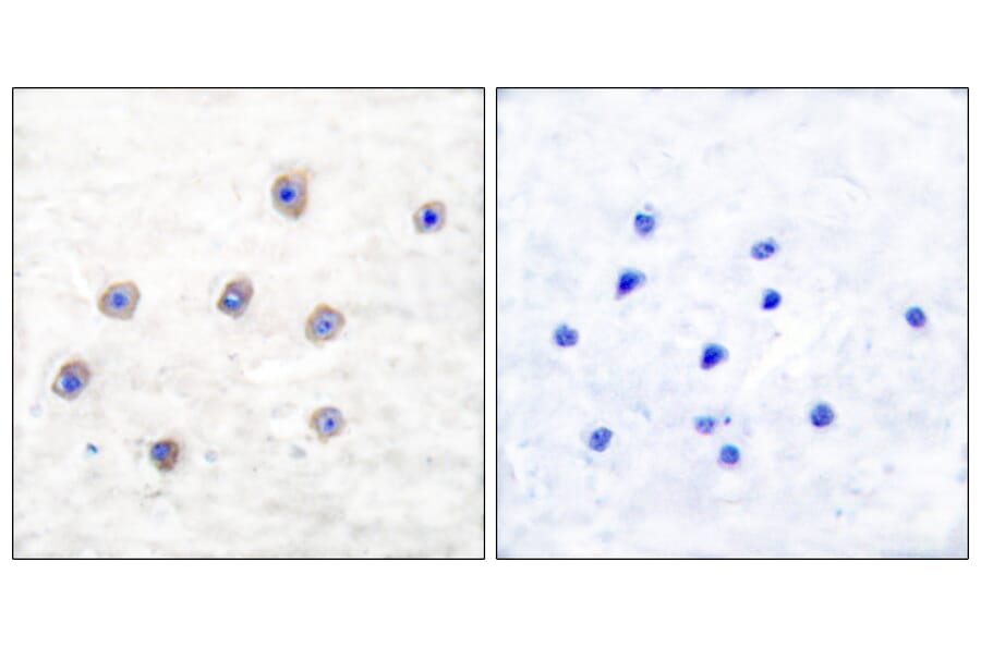 Immunohistochemistry - Anti-Tyrosine Hydroxylase (phospho Ser31) Antibody (A0038) - Antibodies.com