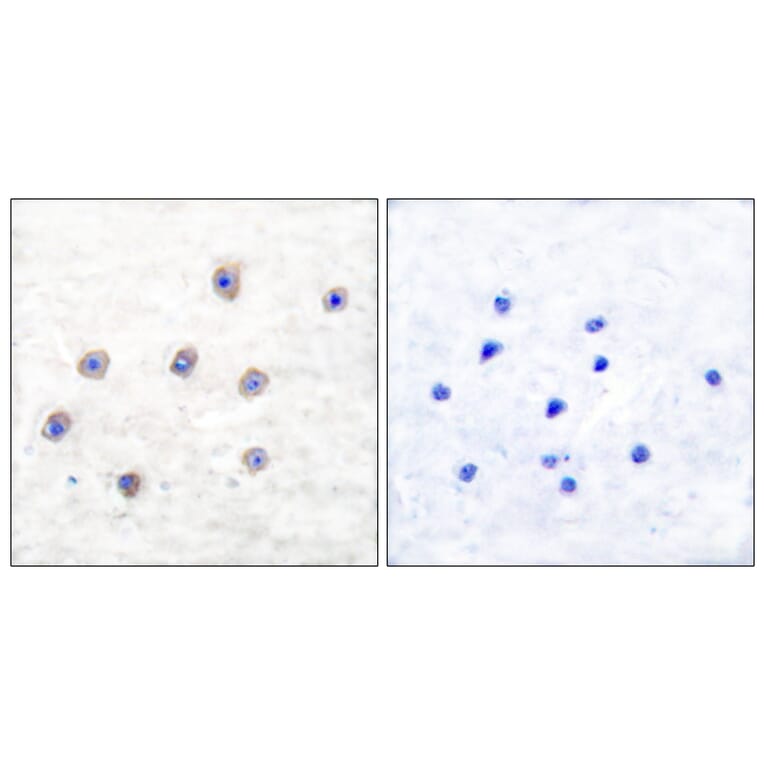 Immunohistochemistry - Anti-Tyrosine Hydroxylase (phospho Ser31) Antibody (A0038) - Antibodies.com