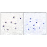 Immunohistochemistry - Anti-Tyrosine Hydroxylase (phospho Ser31) Antibody (A0038) - Antibodies.com