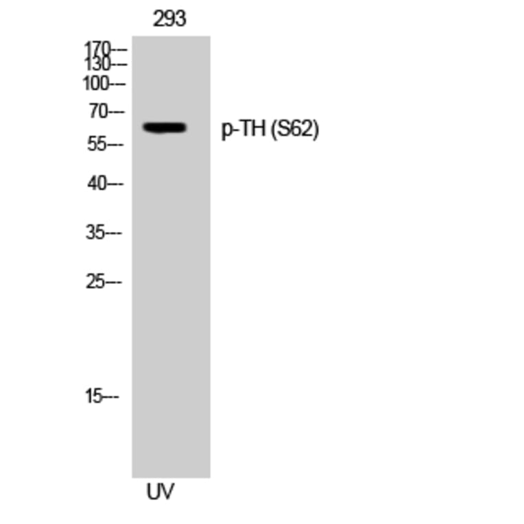 Western Blot - Anti-Tyrosine Hydroxylase (phospho Ser31) Antibody (A0038) - Antibodies.com