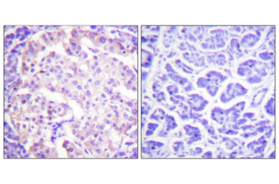 Immunohistochemistry - Anti-Tyrosine Hydroxylase (phospho Ser31) Antibody (A0038) - Antibodies.com