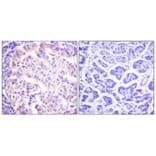 Immunohistochemistry - Anti-Tyrosine Hydroxylase (phospho Ser31) Antibody (A0038) - Antibodies.com