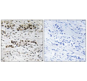 Immunohistochemistry - Anti-Estrogen Receptor-alpha (phospho Ser102) Antibody (A8343) - Antibodies.com