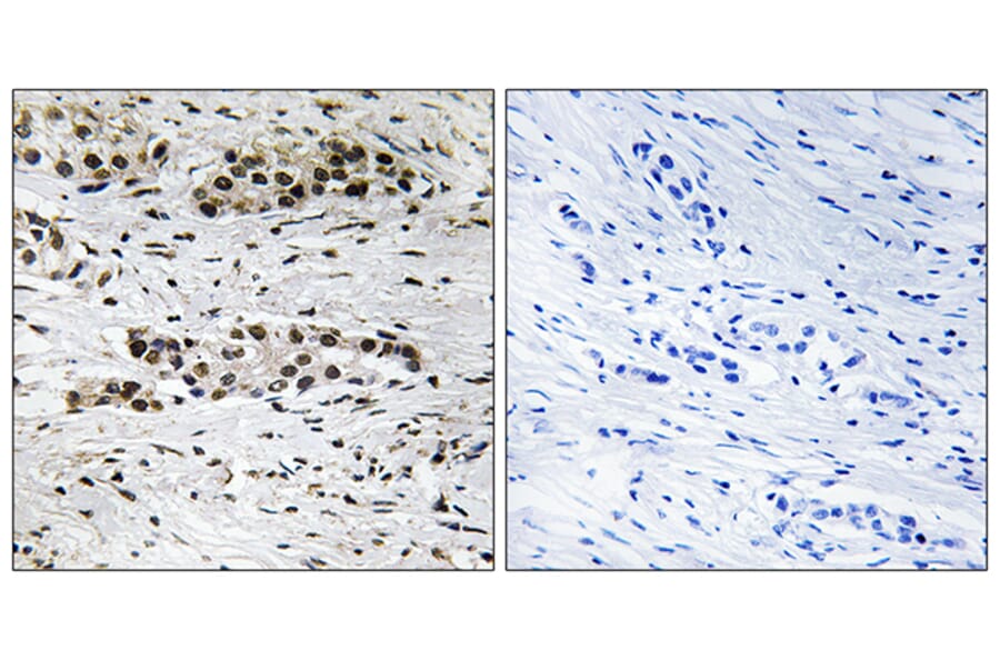 Immunohistochemistry - Anti-Estrogen Receptor-alpha (phospho Ser102) Antibody (A8343) - Antibodies.com