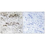 Immunohistochemistry - Anti-Estrogen Receptor-alpha (phospho Ser102) Antibody (A8343) - Antibodies.com