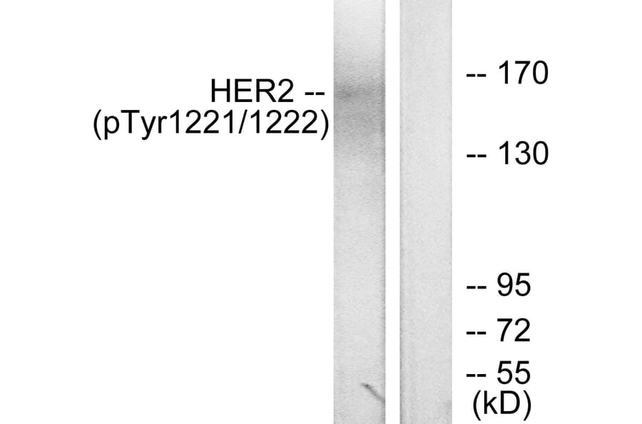 Western Blot - Anti-HER2 (phospho Tyr1221 + Tyr1222) Antibody (A7103) - Antibodies.com