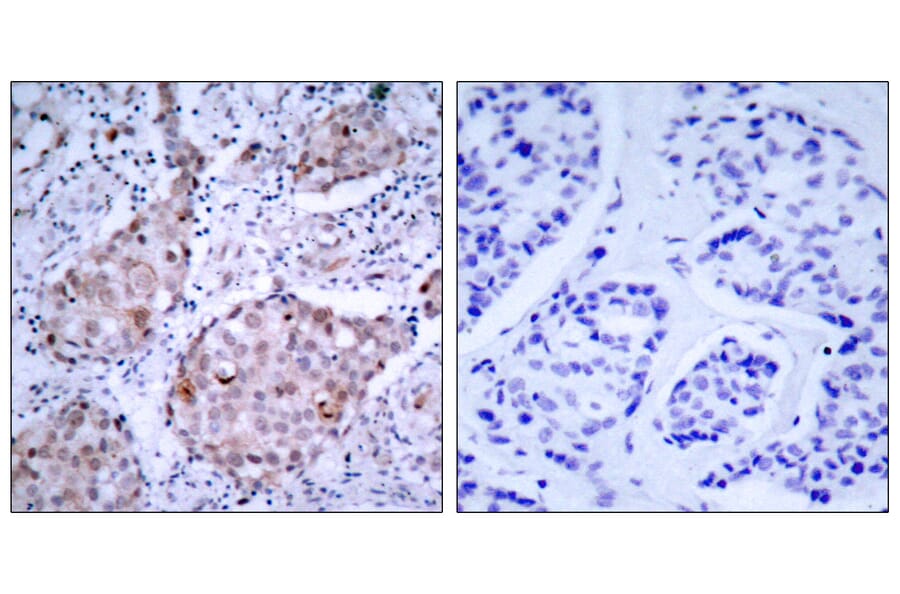 Immunohistochemistry - Anti-HER2 (phospho Tyr1221 + Tyr1222) Antibody (A7103) - Antibodies.com