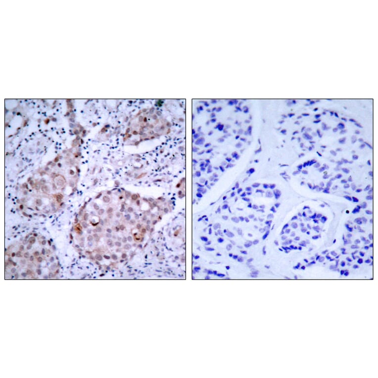 Immunohistochemistry - Anti-HER2 (phospho Tyr1221 + Tyr1222) Antibody (A7103) - Antibodies.com