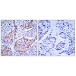 Immunohistochemistry - Anti-HER2 (phospho Tyr1221 + Tyr1222) Antibody (A7103) - Antibodies.com