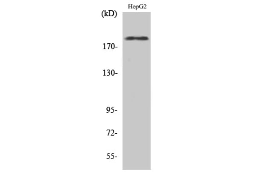 Western Blot - Anti-HER2 (phospho Tyr1221 + Tyr1222) Antibody (A7103) - Antibodies.com