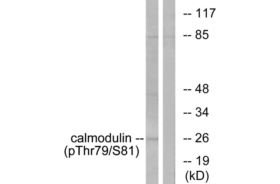 Western Blot - Anti-Calmodulin (phospho Thr79+Ser81) Antibody (A0829) - Antibodies.com
